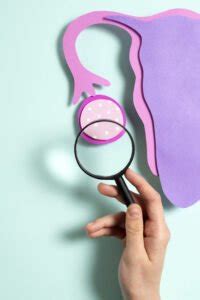 PCOS Matters: Updates in the Diagnosis and Assessment of .